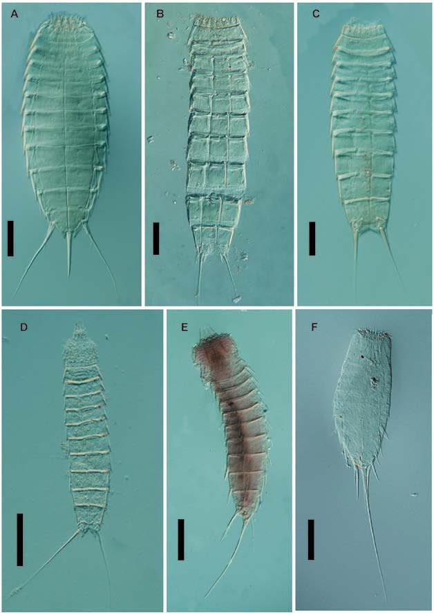 Kinorrincos / nuevas incorporaciones a la colección de invertebrados 