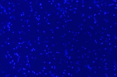 Arqueas antárticas / Alison Murray