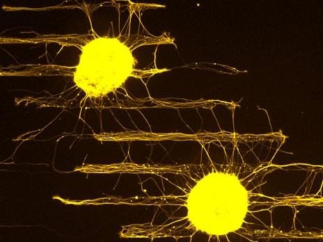 Retinosoles. Una de las imágenes ganadoras / Eloísa Herrera y Verónica Murcia-Belmonte. Instituto de Neurociencias (CSIC-UMH)