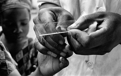 Toma de muestra de sangre. ©OMS Pierre A.Pittet 1958